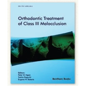 Orthodontic Treatment of Class III Malocclusion 1