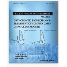 Orthodontic Biomechanics: Treatment of Complex Cases Using Clear Aligner